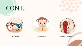 CONT..
M u s c l e a t r o p h y
A n o r e x i a
F a t i g u e
 