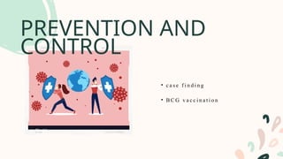 PREVENTION AND
CONTROL
• c a s e f i n d i n g
• B C G v a c c i n a t i o n
 