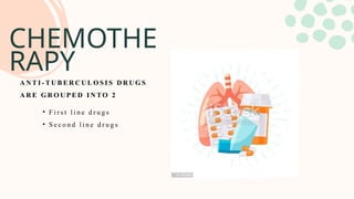 CHEMOTHE
RAPY
• F i r s t l i n e d r u g s
• S e c o n d l i n e d r u g s
A N T I - T U B E R C U L O S I S D R U G S
A R E G R O U P E D I N T O 2
 