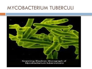 MYCOBACTERIUM TUBERCULI
 