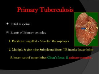 Comprehensive Overview of Tuberculosis: Pathogenesis, Diagnosis, and ...