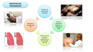 OBJETIVOS DEL
TRATAMIENTO
Prevenir la
muerte por
TB activa
Curar al
paciente y
mejorar su
calidad de
vida
Minimizar las
secuelas
anatómicas y
funcionales
por TB
Prevenir la
recaída por
TB
 