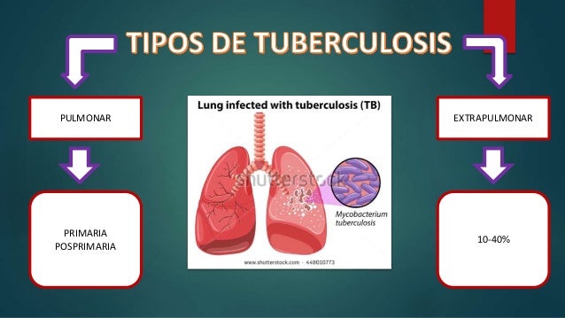 TUBERCULOSIS CONCEPTO FACTORES DE RIESGO PREVENCION COMPLICACIONES TR…
