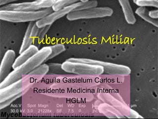Dr. Aguila Gastelum Carlos L. Residente Medicina Interna HGLM Tuberculosis Miliar 