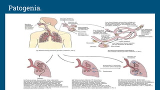 Patogenia.
 