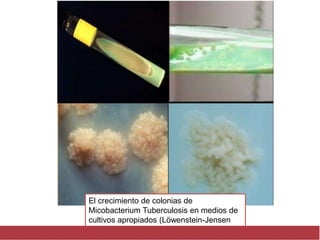 El crecimiento de colonias de
Micobacterium Tuberculosis en medios de
cultivos apropiados (Löwenstein-Jensen
 