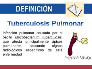 DEFINICIÓN
Infección pulmonar causada por el
bacilo Mycobacterium tuberculosis,
que afecta principalmente ápices
pulmonares, causando signos
radiológicos específicos de está
enfermedad
 