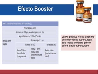 La PT positiva no es sinónimo
de enfermedad tuberculosa,
sólo indica contacto previo
con el bacilo tuberculoso
Efecto Booster
 