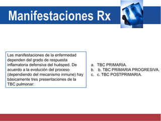 Las manifestaciones de la enfermedad
dependen del grado de respuesta
inflamatoria defensiva del huésped. De
acuerdo a la evolución del proceso
(dependiendo del mecanismo inmune) hay
básicamente tres presentaciones de la
TBC pulmonar:
a. TBC PRIMARIA.
b. b. TBC PRIMARIA PROGRESIVA.
c. c. TBC POSTPRIMARIA.
Manifestaciones Rx
 