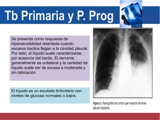 Se presenta como respuesta de
hipersensibilidad retardada cuando
escasos bacilos llegan a la cavidad pleural.
Por esto, el líquido suele caracterizarse
por ausencia del bacilo. El derrame
generalmente es unilateral y la cantidad de
líquido suele ser de escasa a moderada y
sin tabicación.
El líquido es un exudado linfocitario con
niveles de glucosa normales o bajos.
Tb Primaria y P. Prog
 