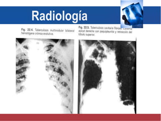 Radiología
 