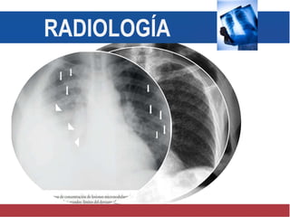 RADIOLOGÍA
 