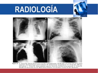 RADIOLOGÍA
 
