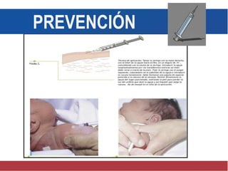 PREVENCIÓN
 