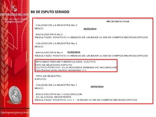 BK DE ESPUTO SERIADO
29/03/2014
30/03/2014
31/03/2014
 