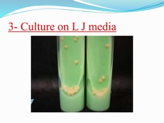 3- Culture on L J media
 