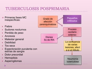 Tuberculosis Primaria.