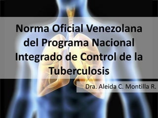 Norma Oficial Venezolana
del Programa Nacional
Integrado de Control de la
Tuberculosis
Dra. Aleida C. Montilla R.
 