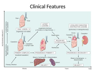 Clinical Features
 