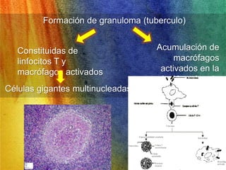 Formación de granuloma (tuberculo) 
Células gigantes multinucleadas 
Acumulación de 
macrófagos 
activados en la 
lesión primaria 
Constituidas de 
linfocitos T y 
macrófagos activados 
 