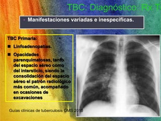 TBC: Diagnóstico: Rx Tórax 
• Manifestaciones variadas e inespecíficas. 
TBC Primaria: 
 Linfoadenopatías. 
 Opacidades 
parenquimatosas, tanto 
del espacio aéreo como 
del intersticio, siendo la 
consolidación del espacio 
aéreo el patrón radiológico 
más común, acompañado 
en ocasiones de 
excavaciones 
Guías clínicas de tuberculosis OMS 2010 
 
