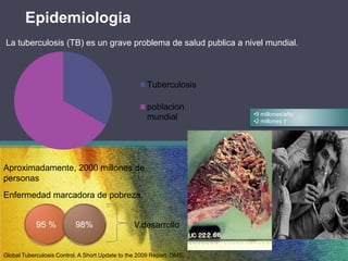 Epidemiologia 
La tuberculosis (TB) es un grave problema de salud publica a nivel mundial. 
Tuberculosis 
poblacion 
mundial 
Aproximadamente, 2000 millones de 
personas 
Enfermedad marcadora de pobreza. 
95 % 98% 
Global Tuberculosis Control. A Short Update to the 2009 Report. OMS. 
•9 millones/año 
•2 millones † 
V.desarrollo 
 