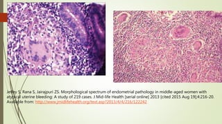 Jetley S, Rana S, Jairajpuri ZS. Morphological spectrum of endometrial pathology in middle-aged women with
atypical uterine bleeding: A study of 219 cases. J Mid-life Health [serial online] 2013 [cited 2015 Aug 19];4:216-20.
Available from: http://www.jmidlifehealth.org/text.asp?2013/4/4/216/122242
 