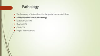 Pathology
 The frequency of lesions found in the genital tract are as follows
 Fallopian Tubes-100% (bilaterally)
 Endometrium-50%
 Ovaries-20%
 Cervix-5%
 Vagina and Vulva<1%
 