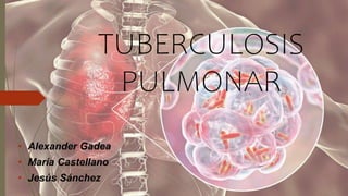 TUBERCULOSIS
PULMONAR
• Alexander Gadea
• María Castellano
• Jesús Sánchez
 