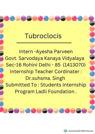 Tuberculosis Ayesha.pdf