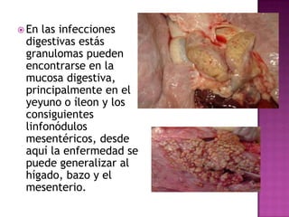  En

las infecciones
digestivas estás
granulomas pueden
encontrarse en la
mucosa digestiva,
principalmente en el
yeyuno o íleon y los
consiguientes
linfonódulos
mesentéricos, desde
aquí la enfermedad se
puede generalizar al
hígado, bazo y el
mesenterio.

 