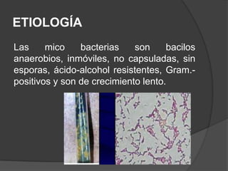 ETIOLOGÍA
Las
mico
bacterias
son
bacilos
anaerobios, inmóviles, no capsuladas, sin
esporas, ácido-alcohol resistentes, Gram.positivos y son de crecimiento lento.

 