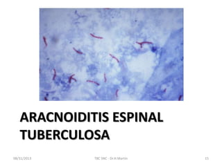 ARACNOIDITIS ESPINAL
TUBERCULOSA
08/31/2013 TBC SNC - Dr.H.Martín 15
 