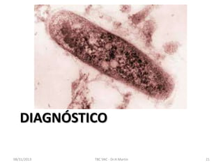 DIAGNÓSTICO
08/31/2013 TBC SNC - Dr.H.Martín 21
 