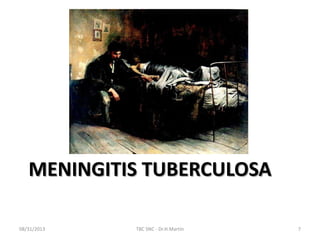 MENINGITIS TUBERCULOSA
08/31/2013 TBC SNC - Dr.H.Martín 7
 