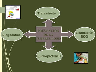 PREVENCIÓN
DE LA
TUBERCULOSIS
Diagnóstico
Tratamiento
Vacunación
BCG
Quimioprofilaxis
 
