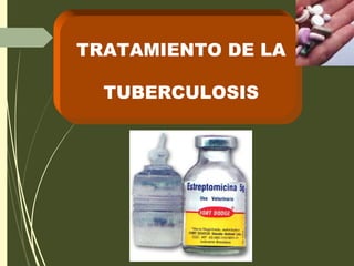 TRATAMIENTO DE LA
TUBERCULOSIS
 