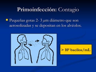 Primoinfección: Contagio
   Pequeñas gotas 2- 3 µm diámetro que son
    aerosolizadas y se depositan en los alvéolos.




                                    > 105 bacilos/mL
 