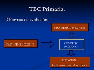 TBC Primaria.
2 Formas de evolución:
                          PROGRESIÓN PRIMARIA




PRIMOINFECCIÓN                      COMPLEJO
                                    PRIMARIO




                                  CURACIÓN.
                         Bacilos en inactividad metabólica
 