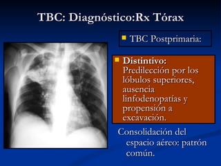TBC: Diagnóstico:Rx Tórax
                    TBC Postprimaria:

             Distintivo:
              Predilección por los
              lóbulos superiores,
              ausencia
              linfodenopatías y
              propensión a
              excavación.
             Consolidación del
                espacio aéreo: patrón
                común.
 
