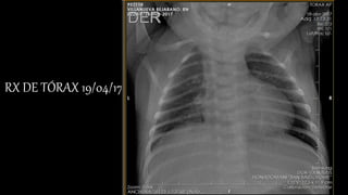 RX DE TÓRAX 19/04/17
 