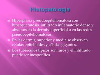    Hiperplasia pseudoepiteliomatosa con
    hiperqueratosis, infiltrado inflamatorio denso y
    abscesos en la dermis superficial o en las redes
    pseudoepiteliomatosas.
   En las dermis, superior y media se observan
    células epitelioides y células gigantes.
   Los tubérculos típicos son raros y el infiltrado
    puede ser inespecífico.
 