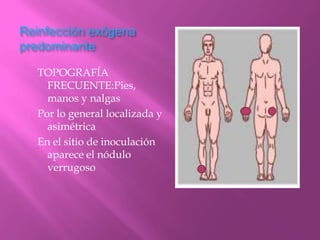 Reinfección exógena
predominante

  TOPOGRAFÍA
    FRECUENTE:Pies,
    manos y nalgas
  Por lo general localizada y
    asimétrica
  En el sitio de inoculación
    aparece el nódulo
    verrugoso
 