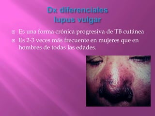    Es una forma crónica progresiva de TB cutánea
   Es 2-3 veces más frecuente en mujeres que en
    hombres de todas las edades.
 