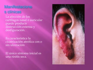 Manifestacione
s clínicas
La afección de los
cartílagos nasal o auricular
puede producir
destrucción extensa y
desfiguración.

Es característica la
cicatrización atrófica con o
sin ulceración

El único síntoma inicial es
una rinitis seca.
 