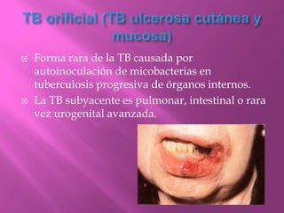    Forma rara de la TB causada por
    autoinoculación de micobacterias en
    tuberculosis progresiva de órganos internos.
   La TB subyacente es pulmonar, intestinal o rara
    vez urogenital avanzada.
 