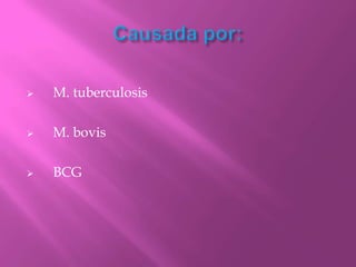    M. tuberculosis

   M. bovis

   BCG
 