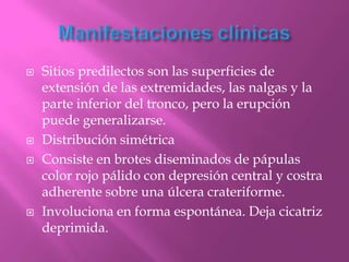   Sitios predilectos son las superficies de
    extensión de las extremidades, las nalgas y la
    parte inferior del tronco, pero la erupción
    puede generalizarse.
   Distribución simétrica
   Consiste en brotes diseminados de pápulas
    color rojo pálido con depresión central y costra
    adherente sobre una úlcera crateriforme.
   Involuciona en forma espontánea. Deja cicatriz
    deprimida.
 