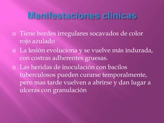    Tiene bordes irregulares socavados de color
    rojo azulado
   La lesión evoluciona y se vuelve más indurada,
    con costras adherentes gruesas.
   Las heridas de inoculación con bacilos
    tuberculosos pueden curarse temporalmente,
    pero mas tarde vuelven a abrirse y dan lugar a
    ulceras con granulación
 