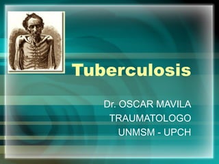 Tuberculosis
Dr. OSCAR MAVILA
TRAUMATOLOGO
UNMSM - UPCH
 